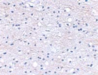 Anti-HAPLN2 antibody(AB124504)