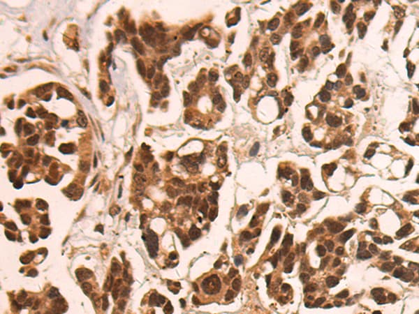 Anti-CAMTA1 antibody(AB199116)