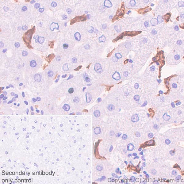 Anti-CD16a antibody [SP189] - C-terminal(AB227665)