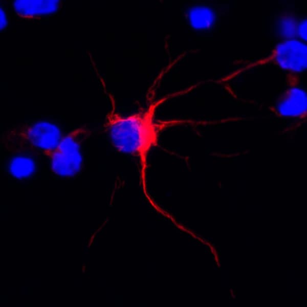 Alpha Internexin Antibody Ep676y Ab40758  Immunocytochemistry Immunofluorescence Img33665