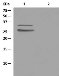 Tip30 Antibody Epr13185 Ab181378  Immunoprecipitation Img129499