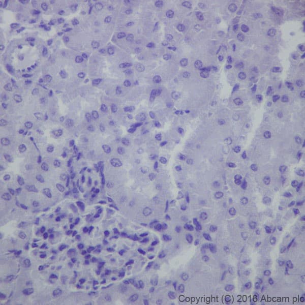 Anti-EAAT2 antibody [EPR19798] - BSA and Azide free(AB271970)