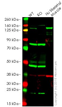 Anti-Collagen VI antibody [EPR17072](AB182744)