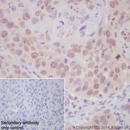 Anti-Cdk4 antibody [EPR4513-32-7](AB108357)