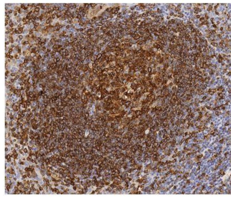 Anti-HLA-DR antibody [TAL 1B5](AB20181)