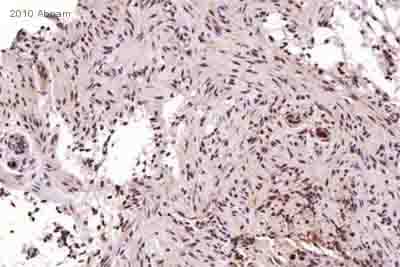Anti-MGMT antibody [MT3.1](AB39253)