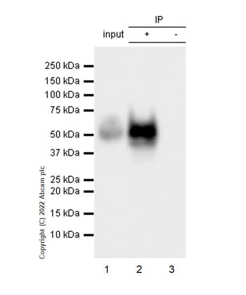 Anti-uPA Receptor/U-PAR antibody [EPR26916-73](AB307895)