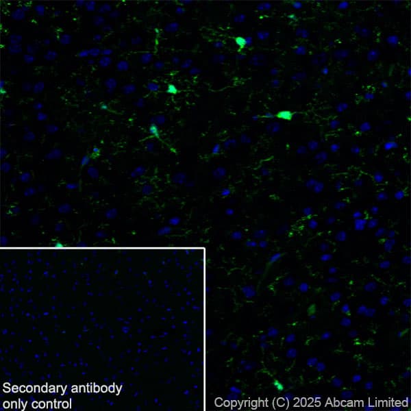 Anti-Iba1 antibody [EPR16589](AB178847)