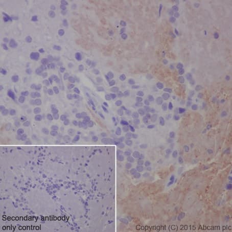 Olfactory Marker Protein Omp Antibody Epr19157 Bsa And Azide Free Ab250713  Immunohistochemistry Formalin Pfa Fixed Paraffin Embedded Sections Img104650