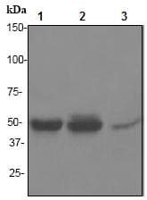 Prkar2b Antibody Ep2648 Bsa And Azide Free Ab284731  Western Blot Img81138