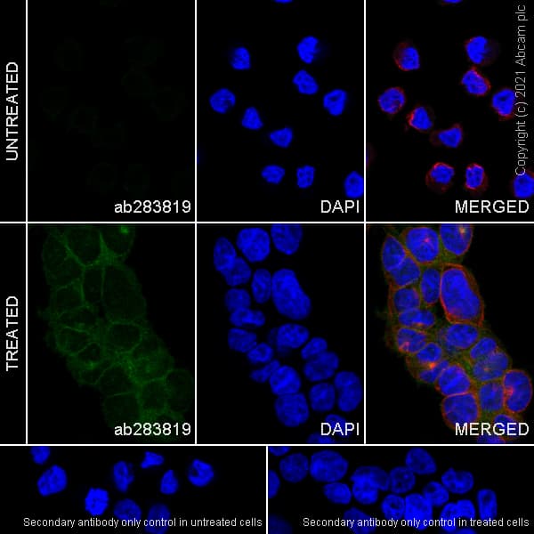 Anti-NLRP3 antibody [RM1021](AB283819)