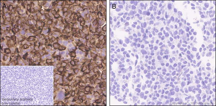Cd96 Antibody Epr26489 23 Bsa And Azide Free Ab315219  Immunohistochemistry Formalin Pfa Fixed Paraffin Embedded Sections Img424259