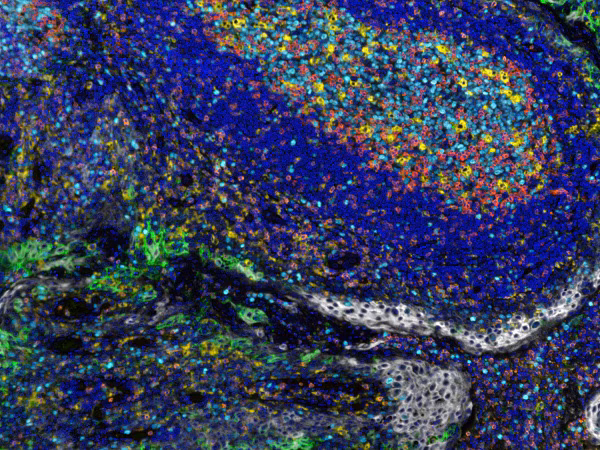 Ki67 Antibody Sp6 Ab16667 Multiplex Immunohistochemistry Img38198