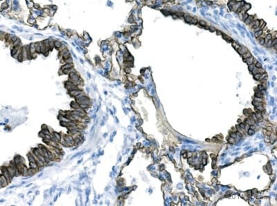 Anti-pan Cytokeratin antibody [AE1/AE3 + 5D3](AB86734)