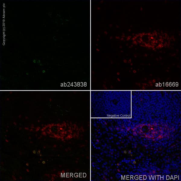 Cd200r Antibody Ox102 Ab243838  Immunohistochemistry Frozen Sections Img62978