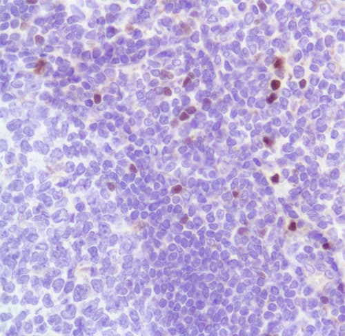Anti-FOXP3 antibody [SP97](AB99963)