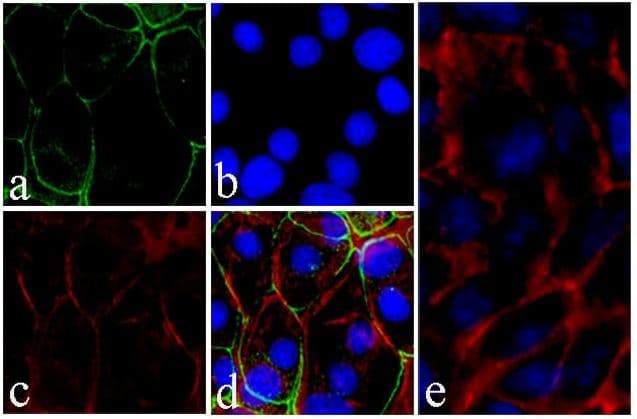 Anti-ICAM1 antibody [RP23040065](AB307993)