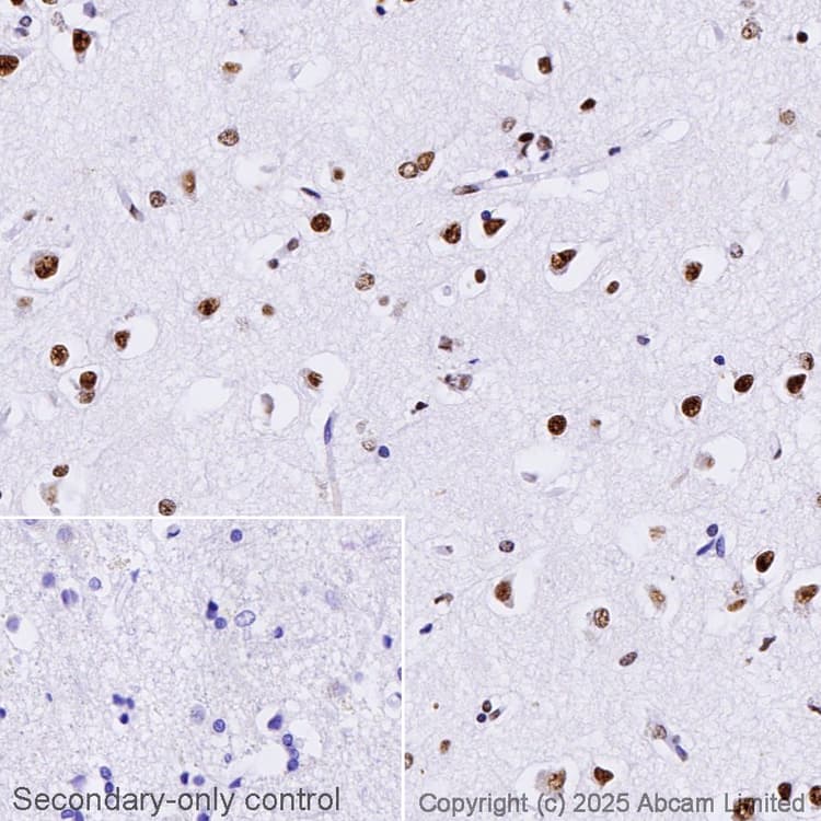 Anti-TDP43 antibody [EPR5810](AB109535)