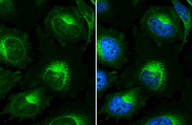 Beta 2 Microglobulin Antibody Ab227261  Immunocytochemistry Immunofluorescence Img450486