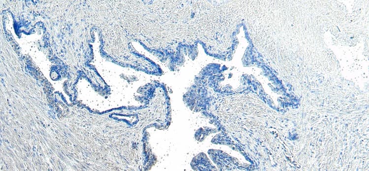 Anti-VPS35 antibody(AB10099)