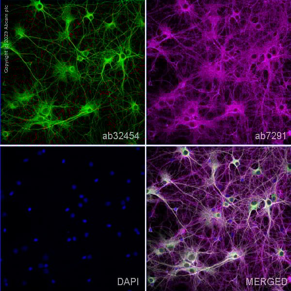 Anti-MAP2 antibody - Neuronal Marker(AB32454)