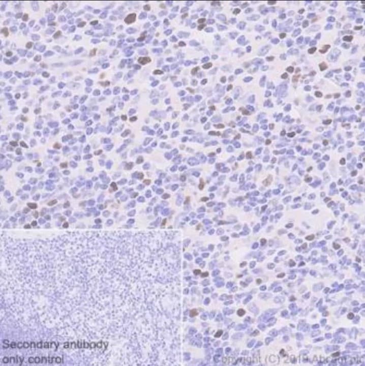 Anti-FOXP3 antibody [236A/E7] - BSA and Azide free(AB96048)