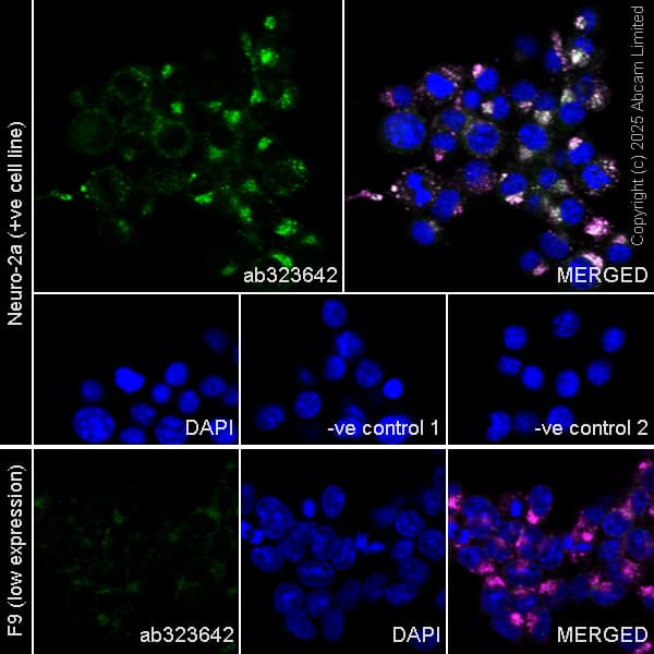 Anti-LAMP2 antibody [H4B4] - Lysosome Marker(AB25631)