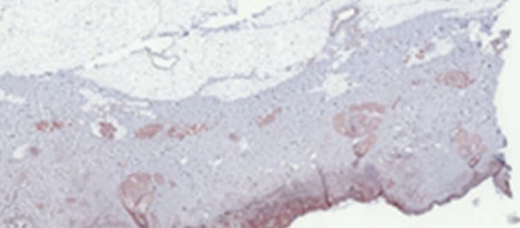 AEC Substrate Kit(ab64252)