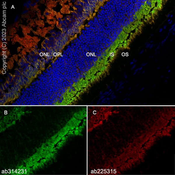 Anti-RS1 antibody [EPR28513-78](AB314231)