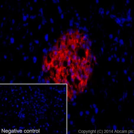 Anti-Insulin antibody [EPR17359](AB181547)