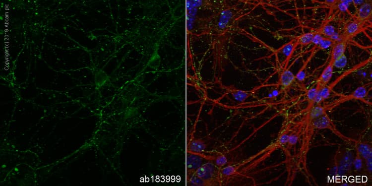 Anti-GAD65 + GAD67 antibody [EPR19366](AB183999)