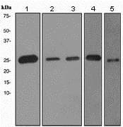 Anti-PGP9.5 antibody [EPR4118] - Neuronal Marker(AB108986)