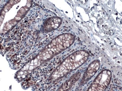 Anti-Rad51 antibody [14B4](AB213)