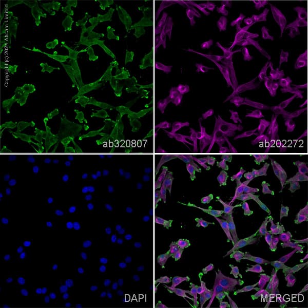 Alexa Fluor 594 Alpha Tubulin Antibody Ep1332y Microtubule Marker Ab202272  Immunocytochemistry Immunofluorescence Img434828