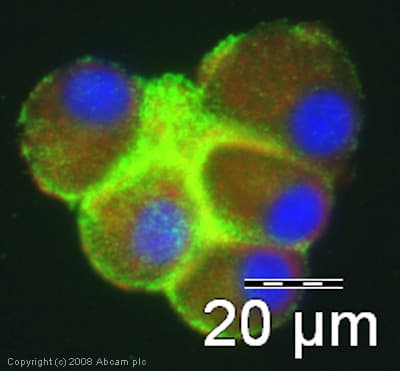 Anti-Myelin Basic Protein antibody(AB40390)