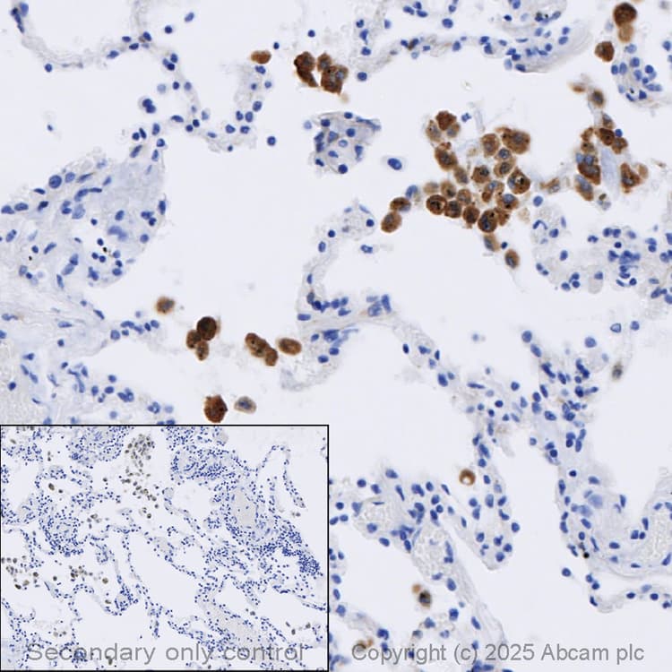 Anti-iNOS antibody [RM1017](AB283655)