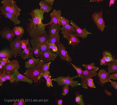 Anti-Transferrin Receptor antibody [MEM-75](AB9179)