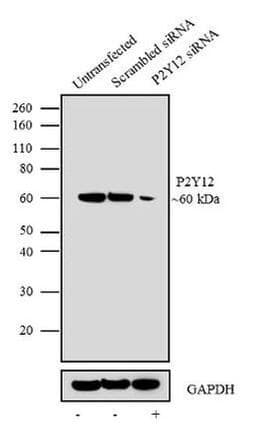 Anti-P2Y12 antibody [RP23040204](AB308032)