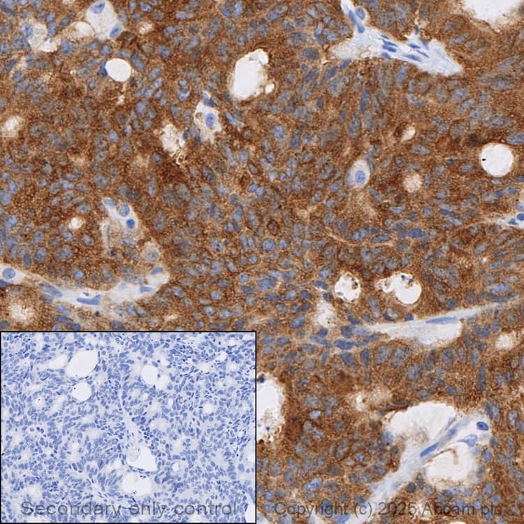 Anti-Hexokinase II antibody [EPR20839](AB209847)