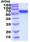 Recombinant human AMF protein (Bioactivity Validated)(AB208311)