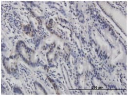 P53 Phospho S46 Antibody 36 Ab122898  Immunohistochemistry Formalin Pfa Fixed Paraffin Embedded Sections Img25270