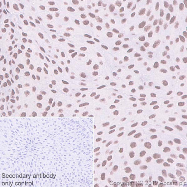 Anti-BRG1 antibody [EPR3912](AB108318)