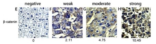 Anti-beta Catenin antibody [E247] - ChIP Grade(AB32572)
