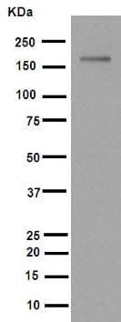 Anti-MSH6 antibody [EPR3945](AB92471)