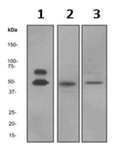 Anti-CaMKII alpha antibody [EPR1828](AB92332)