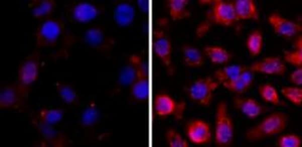Anti-acetyl Lysine antibody [RM101](AB190479)