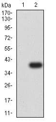 Anti-P2Y12 antibody [1C2A9](AB233760)