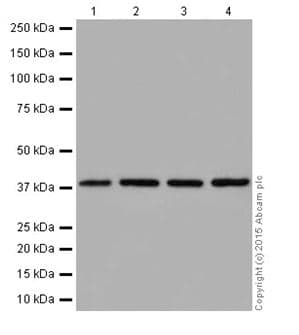 Anti-ATP6V0D1/P39 antibody [EPR18320-38](AB202899)