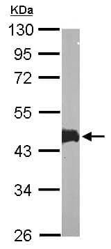 Anti-MK-3 antibody(AB155178)