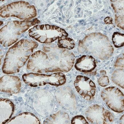 Carbonic Anhydrase 12 Ca12 Antibody Cl0278 Ab242316  Immunohistochemistry Formalin Pfa Fixed Paraffin Embedded Sections Img133102